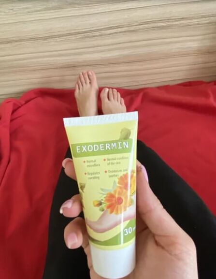 Yesenia's Exodermin cream review