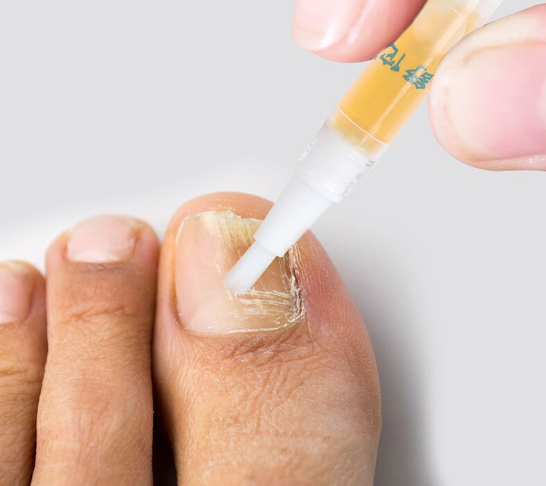 Liquid to treat toenail fungus