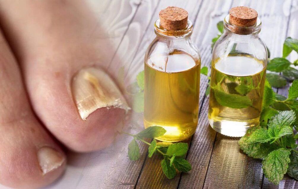 Toenail Fungus Vinegar