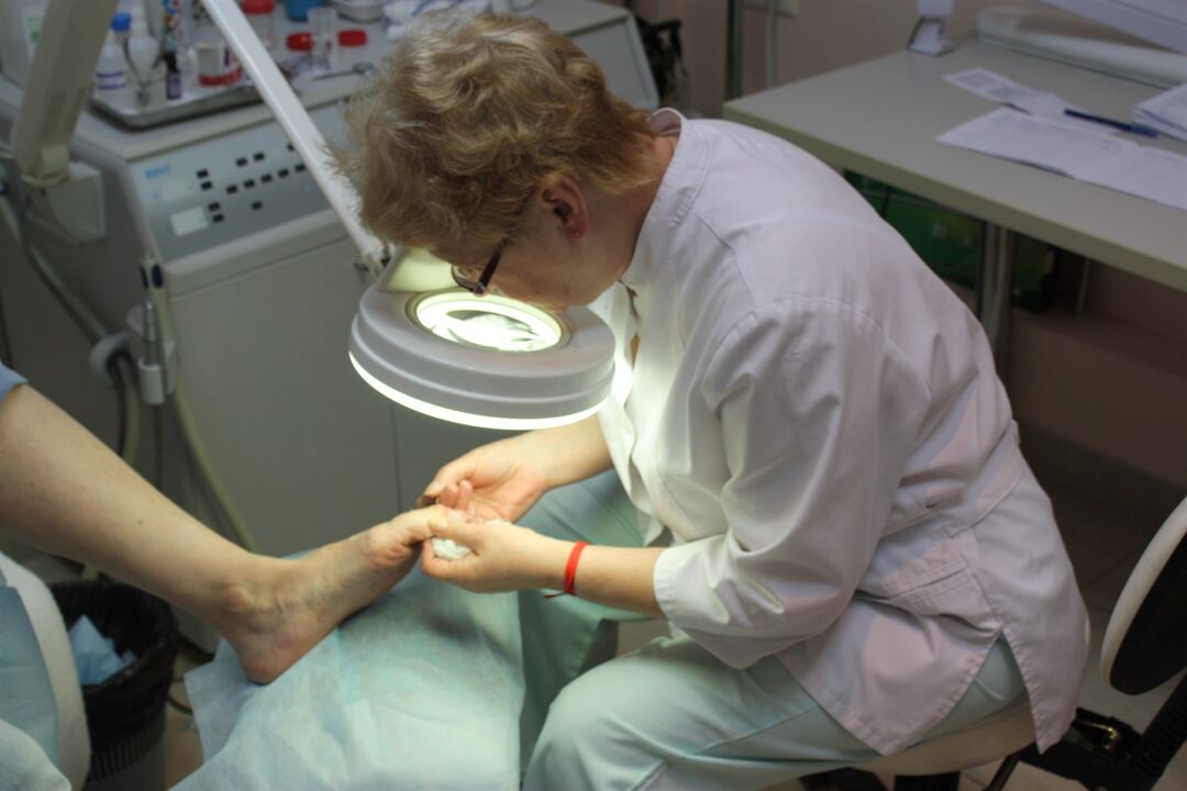 Alarming development of toenail fungus calls for surgeon's help