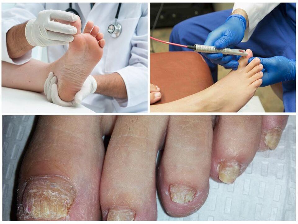 Doctors diagnose and treat toenails affected by fungal infections. 